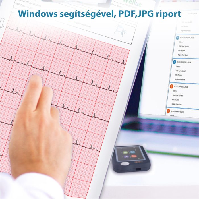 Viatom Pulsebit - Személyi EKG nyomkövető /Egészségmonitor - Image 4