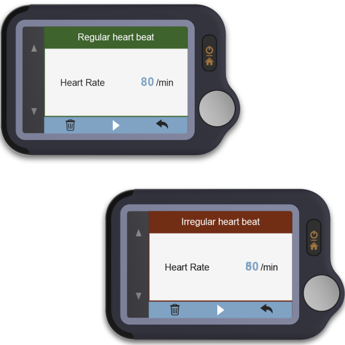 Viatom Pulsebit - Személyi EKG nyomkövető /Egészségmonitor - Image 11