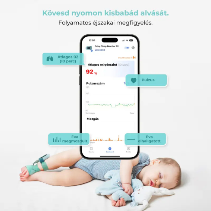 Babytone okos légzésfigyelő zokni babáknak - Image 2