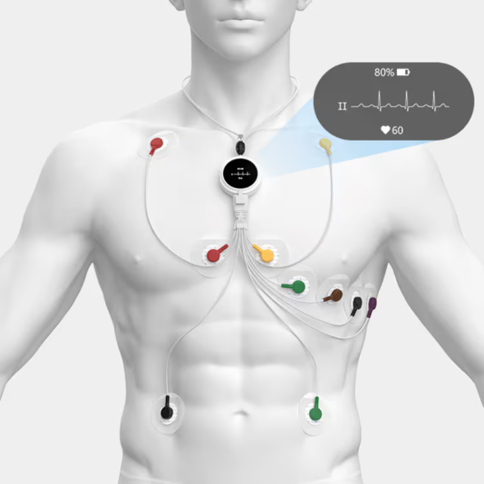 Viatom Lepod Pro ER3 12 elvezetéses 24 órás mini EKG holter monitor - Image 3