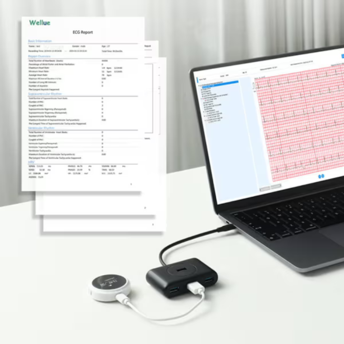 Viatom Lepod Pro ER3 12 elvezetéses 24 órás mini EKG holter monitor - Image 5