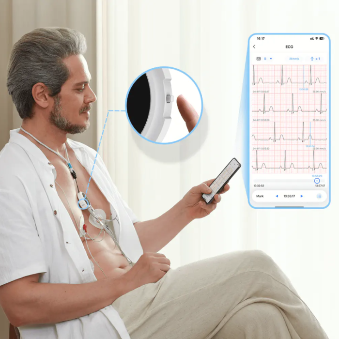 Viatom Lepod Pro ER3 12 elvezetéses 24 órás mini EKG holter monitor - Image 4